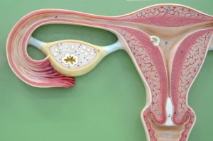 Лечение фибромы матки 