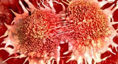 Жир транспортирует раковые клетки в организме, вызывая метастазы
